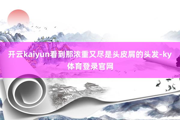 开云kaiyun看到那浓重又尽是头皮屑的头发-ky体育登录官网